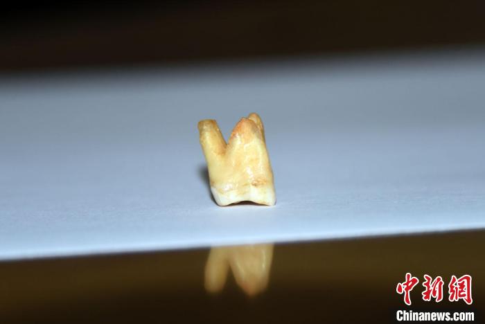 你會的剔牙，這群古人類8-12萬年前就會了